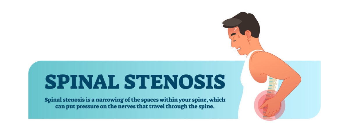 Spinal Stenoz - Dar kanal hastalığı